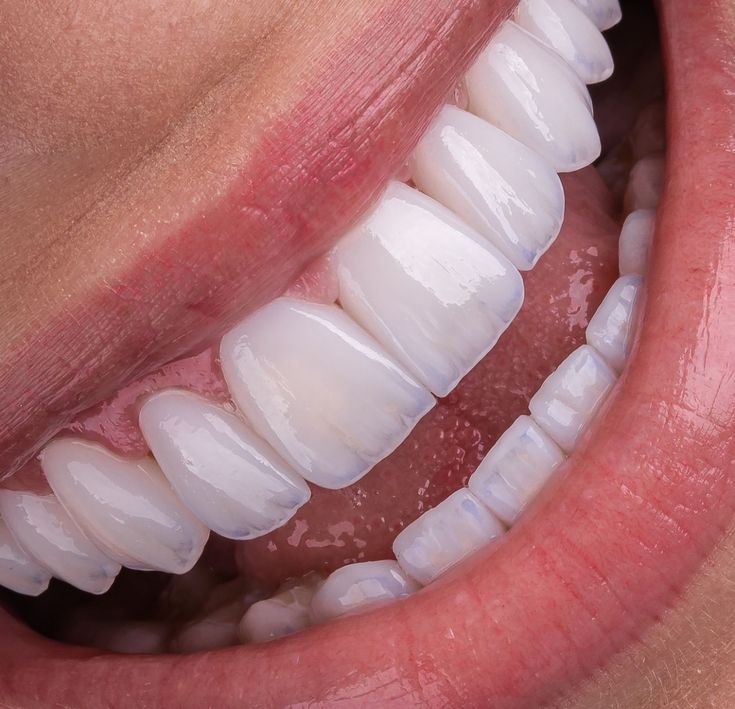 Servicio de Cirugía Plástica Periodontal en Panamá