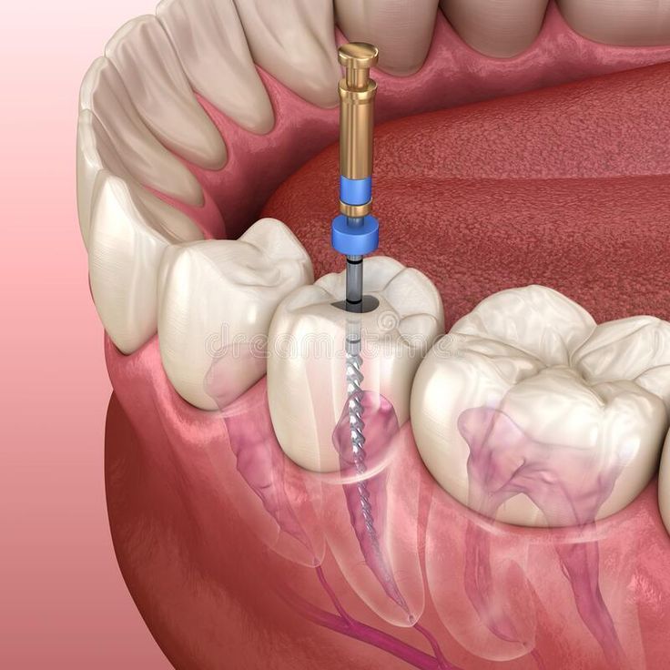Servicio de Tratamiento de Enfermedad Periodontal en Panamá